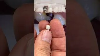 Thumbnail: Mini-SYTON Ti-ZEN for Dr. John Vargas in New York