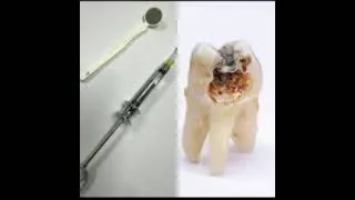Thumbnail: Dentist's advice to us especially during the festive season when a lot of sugary foods consumed.