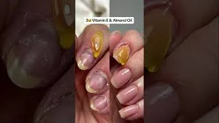 Thumbnail: 🎬 5 Nail Treatments That Actually WORK 💅|#makeuptutorial |#nailart |#naildesign |#nails |#beautytips