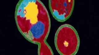 Thumbnail: St Jude Children's Research Hospital Microscope Video Footage With Dr. Jax