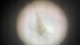 Thumbnail: Artemia culture, live fish feed #dbtstar  @thassimbeeviabdulkadercoll9350 @MBBT-TBAKCW