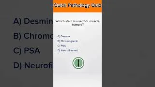 Thumbnail: Pathology Quiz: Benign vs Malignant Tumors | 7 High-Yield MCQs #shorts#mcqmedacademy