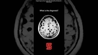 Thumbnail: Brain MRI Question 25