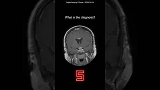 Thumbnail: Brain MRI Question 23