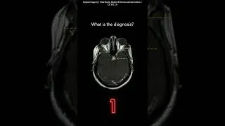 Thumbnail: Brain MRI Question 22