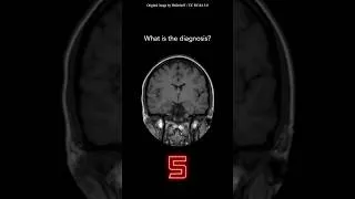 Thumbnail: Brain MRI Question 21