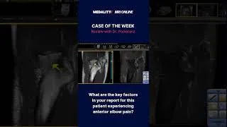 Thumbnail: Elbow MRI Radiology Case | Dr. Stephen Pomeranz