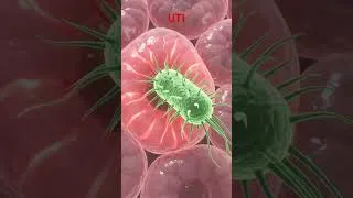 Thumbnail: 3D animation of urinary tract Infection| UTI Mani cause of it?| #shorts