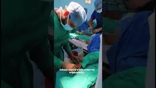 Thumbnail: Finger external fixator removal..#doctors #orthopedics #surgery #operationtheatre #hospital