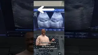 Thumbnail: Paciente con calculos a la vesícula #dolor #dolorpelvico