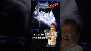 Thumbnail: ¿Te gustaria ver tu bebe de 12 semanas? #dolor #embarazo