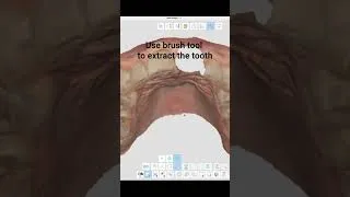 Thumbnail: Digital extraction