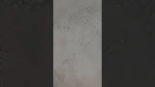 Thumbnail: Dalmau Plate microscopy #shorts