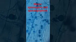 Thumbnail: Mucor sporangium and sporangiophores #shorts #fungus  #microscope