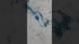Thumbnail: Penicillium in LPCB tease mount of culture #shorts  #microscope #fungus