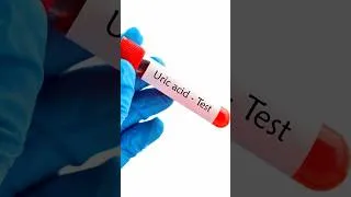 Thumbnail: Uric Acid Explained: Causes, Synthesis & Treatment | RFT Part :- 5 | MedPathshala