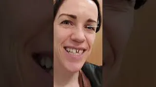Thumbnail: *The days are long, but the years are short* (my 2 year post jaw surgery recap in 30 seconds)