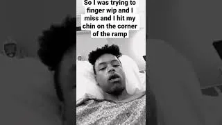 Thumbnail: broke my jaw riding a scooter 2021