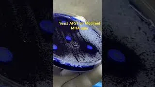 Thumbnail: Yeasts AFST on Modified MHA agar #shorts #fungus