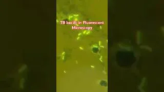 Thumbnail: Auramine O stain sputum showing TB bacilli (AFB) by Light Emitting Diode(LED) Fluorescent Microscopy