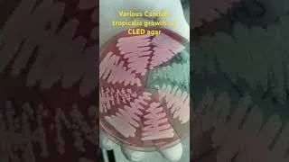 Thumbnail: Various Candida growth on CLED agar after 48 hours of incubation #shorts  #fungi  #yeast