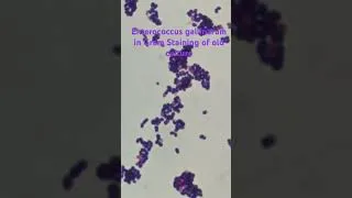 Thumbnail: Enterococcus gallinarum in Gram staining #microscope #shorts