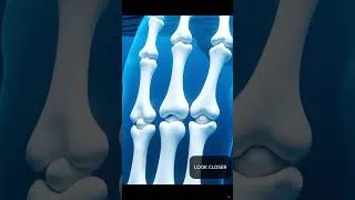 Thumbnail: Whales Have Finger Bones Inside Their Fins