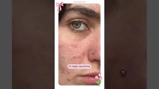 Thumbnail: Shower habits that are secretly breaking you out 🧼