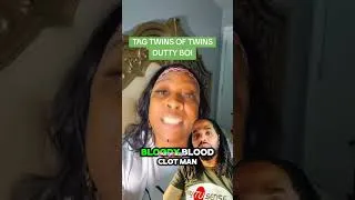 Thumbnail: Omg ! 😱 Macka Diamond Roasted The Sh!T Out Of Tu Lox From Twins Of Twins & Flamed His A$$‼️