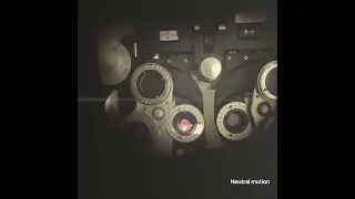 Thumbnail: Retinoscopy