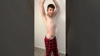Thumbnail: Are my scars THAT bad?
