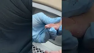 Thumbnail: How to repair it?😊 #nailrepair #nailtip #nailtutorial #longnails #manicure
