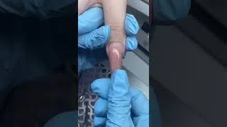 Thumbnail: Two problems, 1 solution💪 #nailrepair #nailshape #nailtutorial