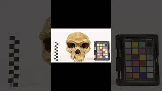 Thumbnail: Impossible Discovery Inside Skull! 💀☠️