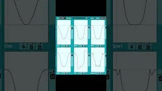 Thumbnail: Tween Trick EVERY Dev Should Know #gamedev #pixelart #godot