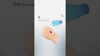 Thumbnail: How to use KeriCure® Field Shield® #bethedifference #traumainformed #beprepared