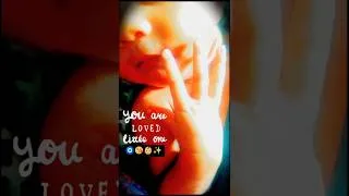 Thumbnail: Cute baby | Adorable baby #viral #trending #cutebaby # #ytshorts #song #love