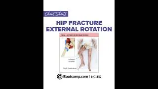 Thumbnail: 🦴 Hip Fracture NCLEX Review | NCLEX Bootcamp Cheat Sheet
