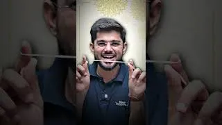 Thumbnail: Ye Rakhi Kuch Zyada Hi Special Hai! 👀🔥
