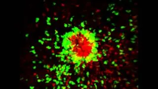 Thumbnail: Role of integrins in neutrophil migration and swarm formation