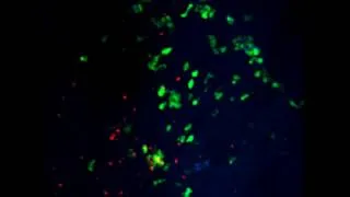 Thumbnail: Neutrophils responding to a skin barrier breach