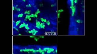 Thumbnail: Movie 15: Sequential migration of neutrophils from the epidermis/dermis into sites of sand fly...