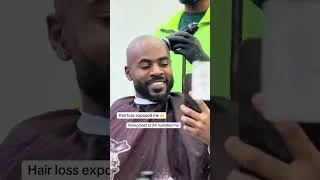 Thumbnail: Losing my hair changed everything #bad #acceptance #resentment #strongmen #blackmen #hairloss #hair