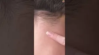Thumbnail: Genius Vicks VapoRub Hacks Only Our Grandparents Knew