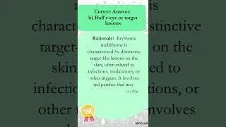 Thumbnail: Are You Smarter Than a Doctor? Test Your Medical Knowledge! Q188