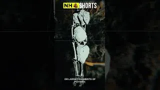 Thumbnail: Zombies in Ancient Greece! #shorts