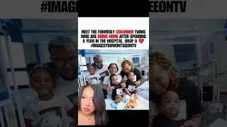 Thumbnail: After Spending a Year in the Hospital, These Formerly Conjoined Twins Are Finally Going Home 🥹🏡
