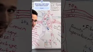 Thumbnail: Right-sided heart failure: What happens? #anatomyandphysiology #nursing #nursingstudent