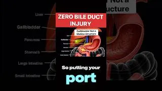 Thumbnail: How to proper visualization and exposure for gallbladder surgery