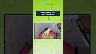 Thumbnail: 70% Doctors fail to Guess the Diagnosis #doctor #medicalchallenge